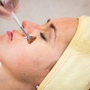CHEMICAL PEELS West Palm Beach Gardens Florida CHEMICAL PEELS West Palm Beach Gardens Florida